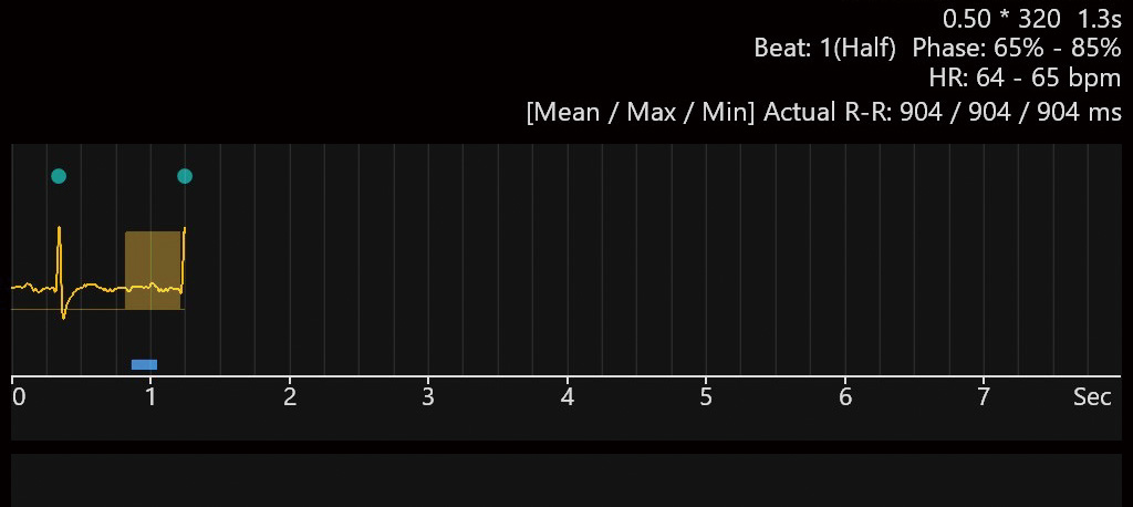 同一患者の冠動脈CT a