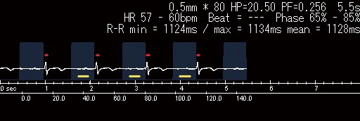 同一患者の冠動脈CT b