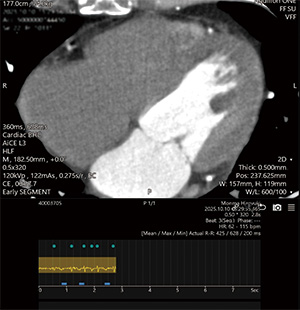 セグメント再構成