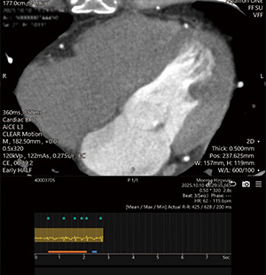 CLEAR Motionを使用