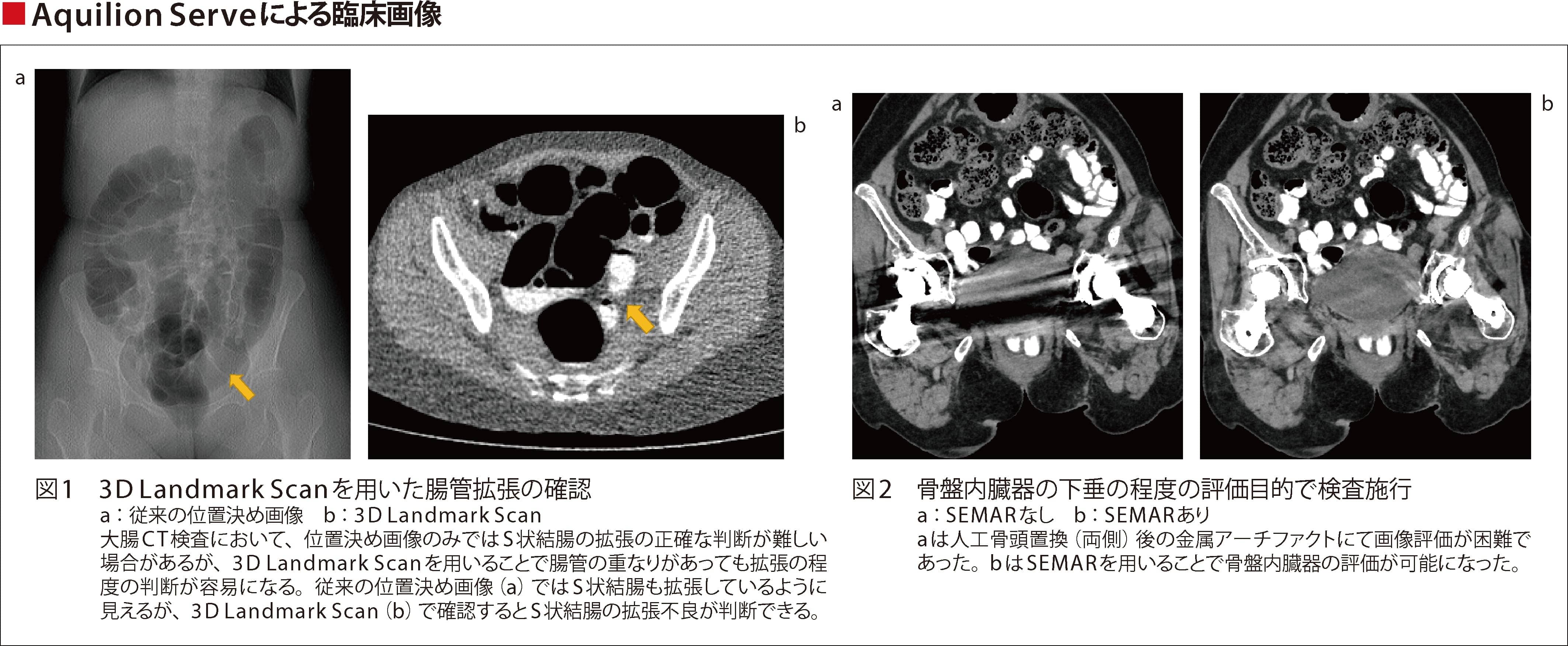 大腸がん撲滅」を掲げ、年間600件の大腸CT検査を行う専門病院で