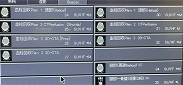 Vitrea解析の精度と臨床的有用性の写真