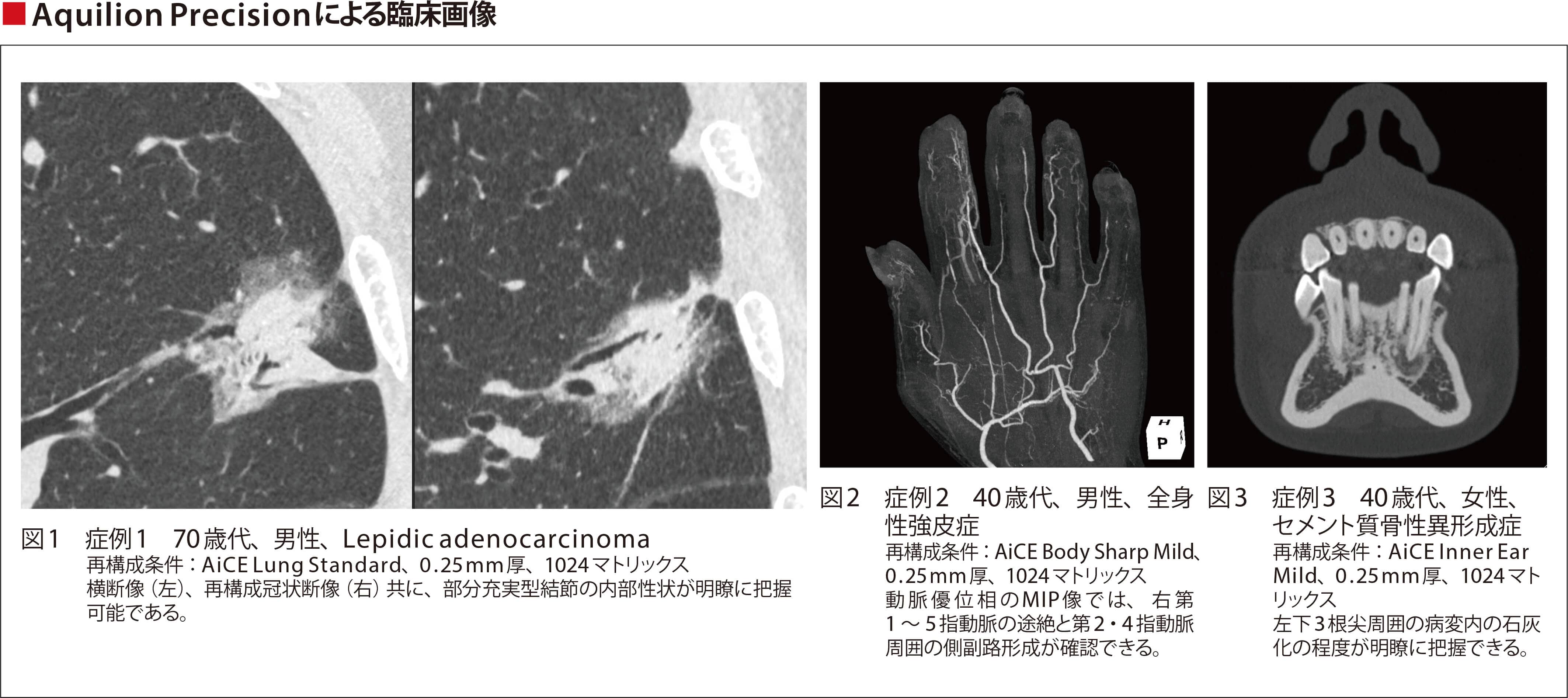 Aquilion Precisionによる臨床画像