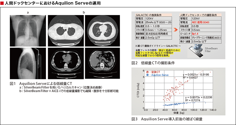 人間ドックセンターにおけるAquilion Serveの運用