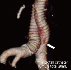 4D-CT