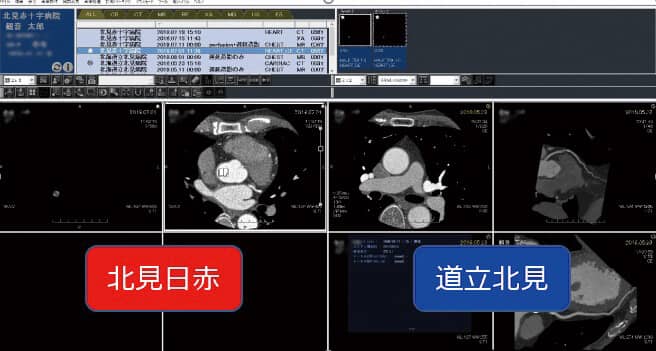 図2 AbiertoPACSのビューワでの2病院の画像情報の参照
