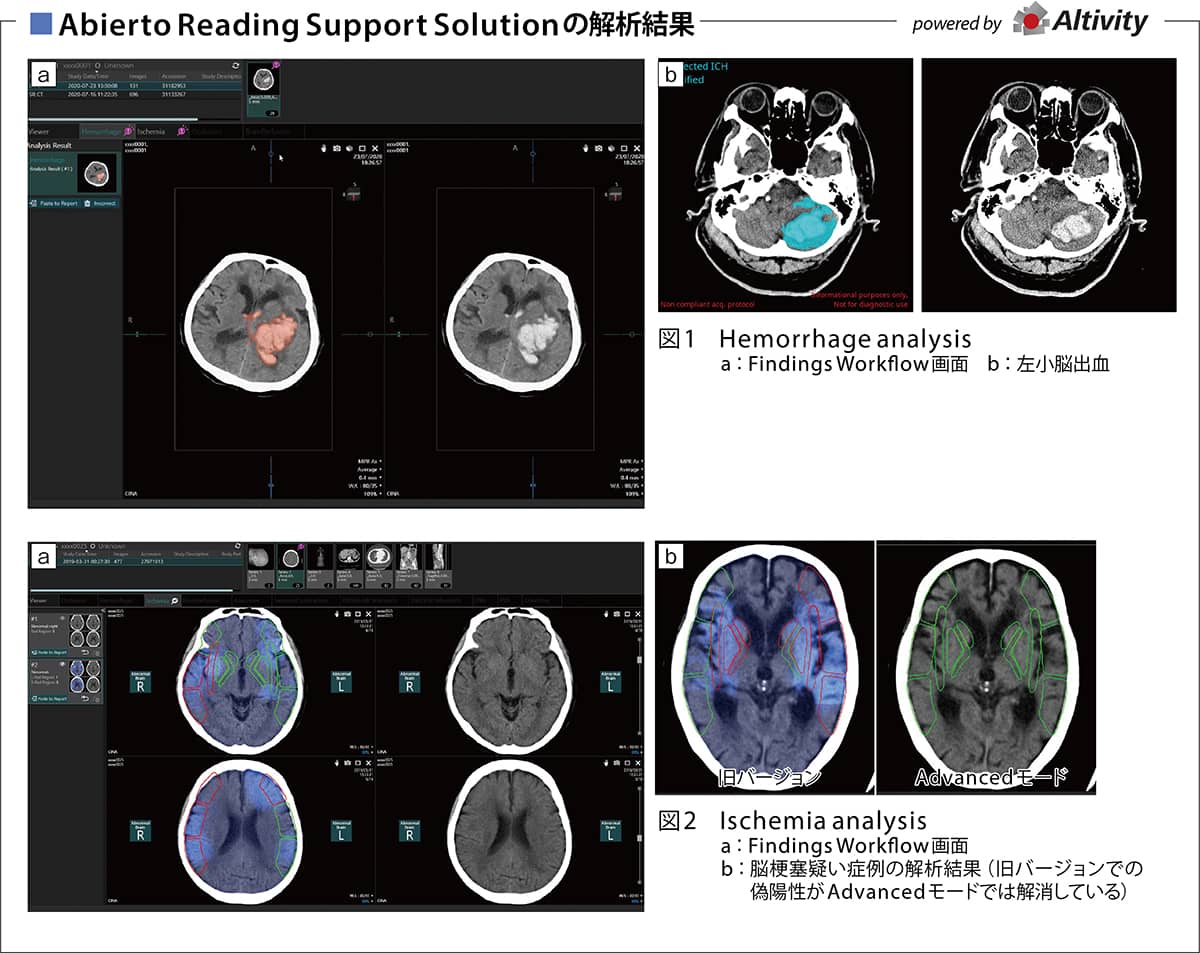 Abierto Reading Support Solutionの解析結果
