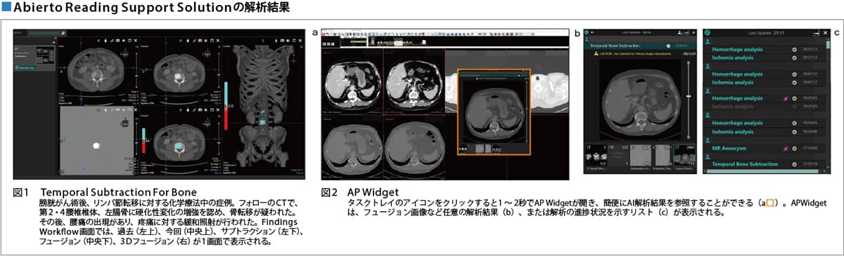 Abierto Reading Support Solutionの解析結果