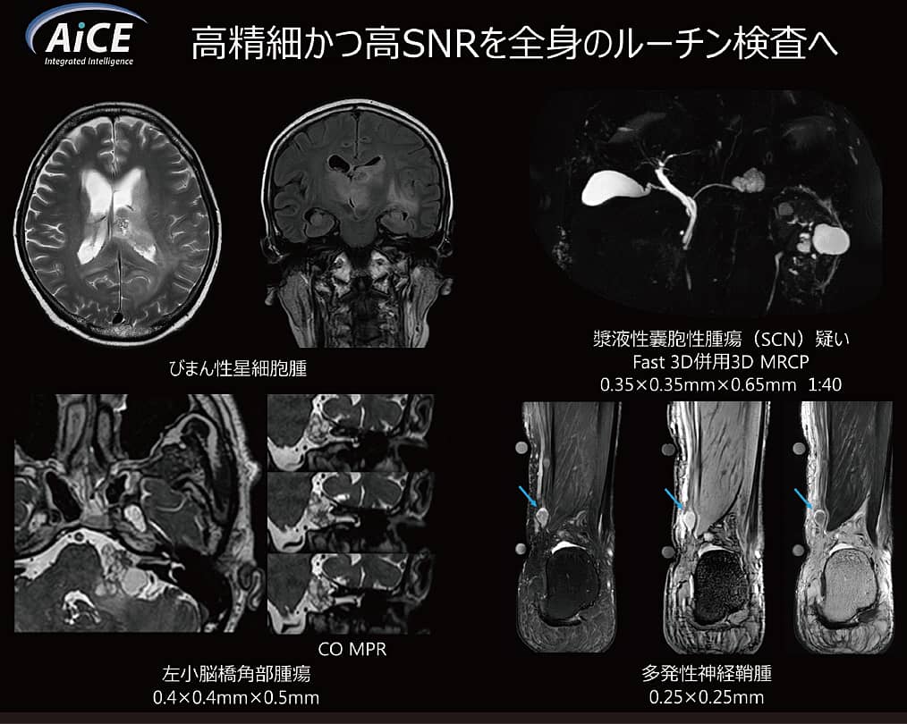 AiCEの画像