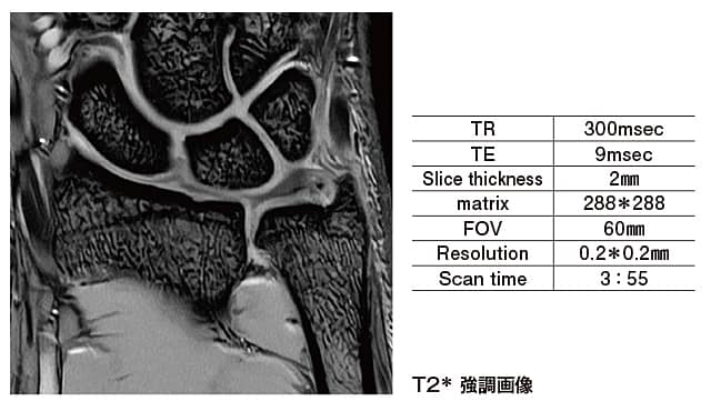 T2強調画像