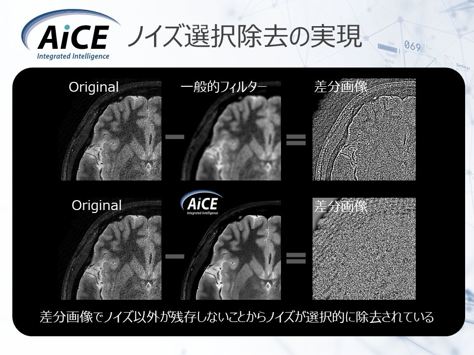 図3 AiCEによるノイズ選択除去の実現