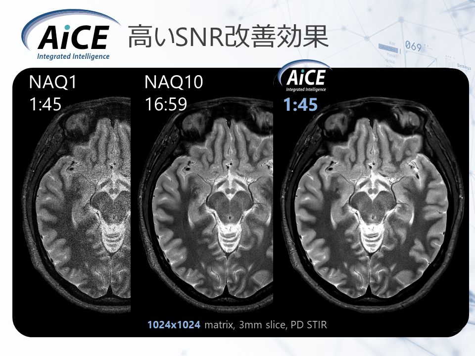 図4 AiCEによる高いSNR改善効果