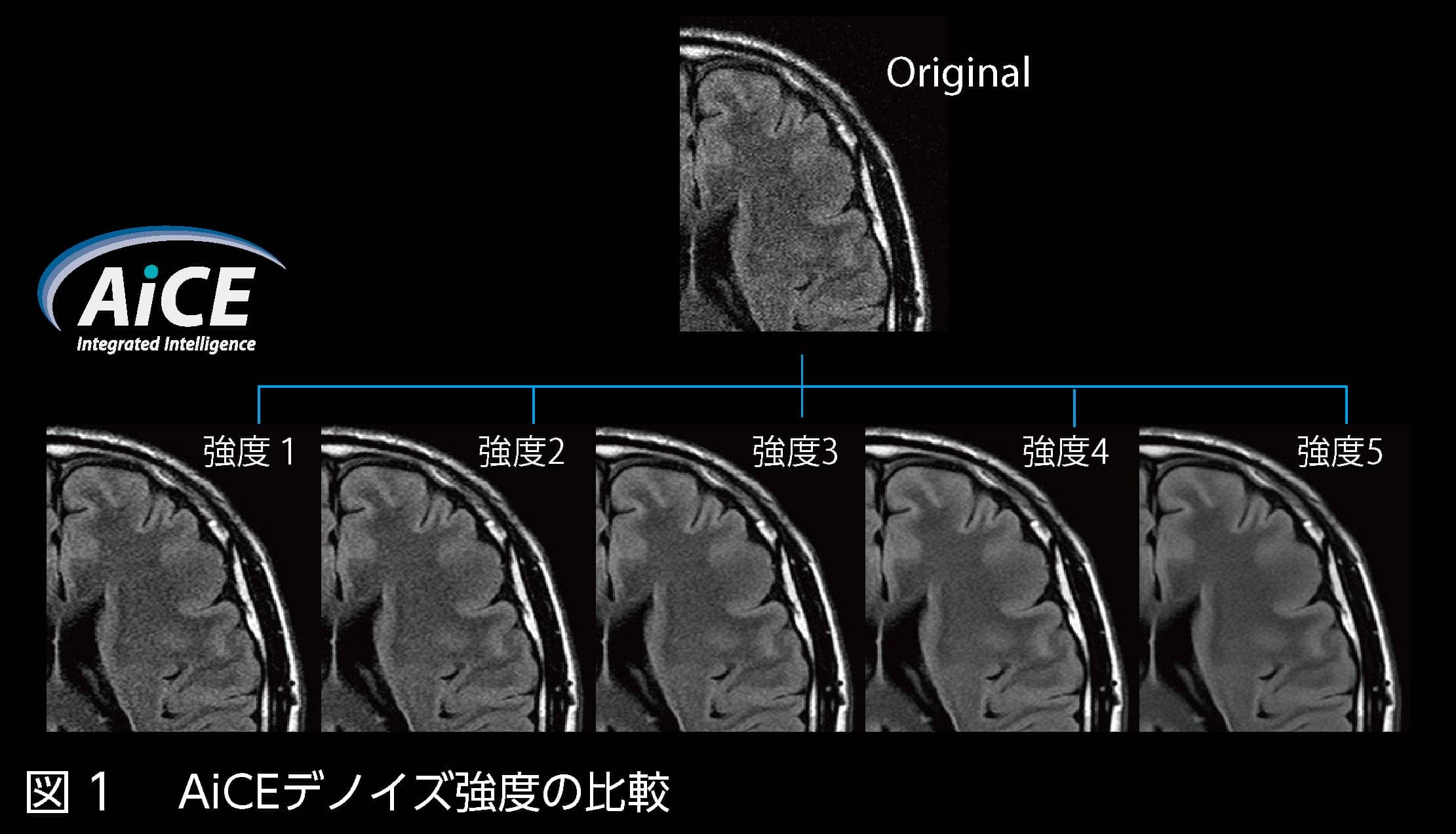 図1 AiCEデノイズ強度の比較