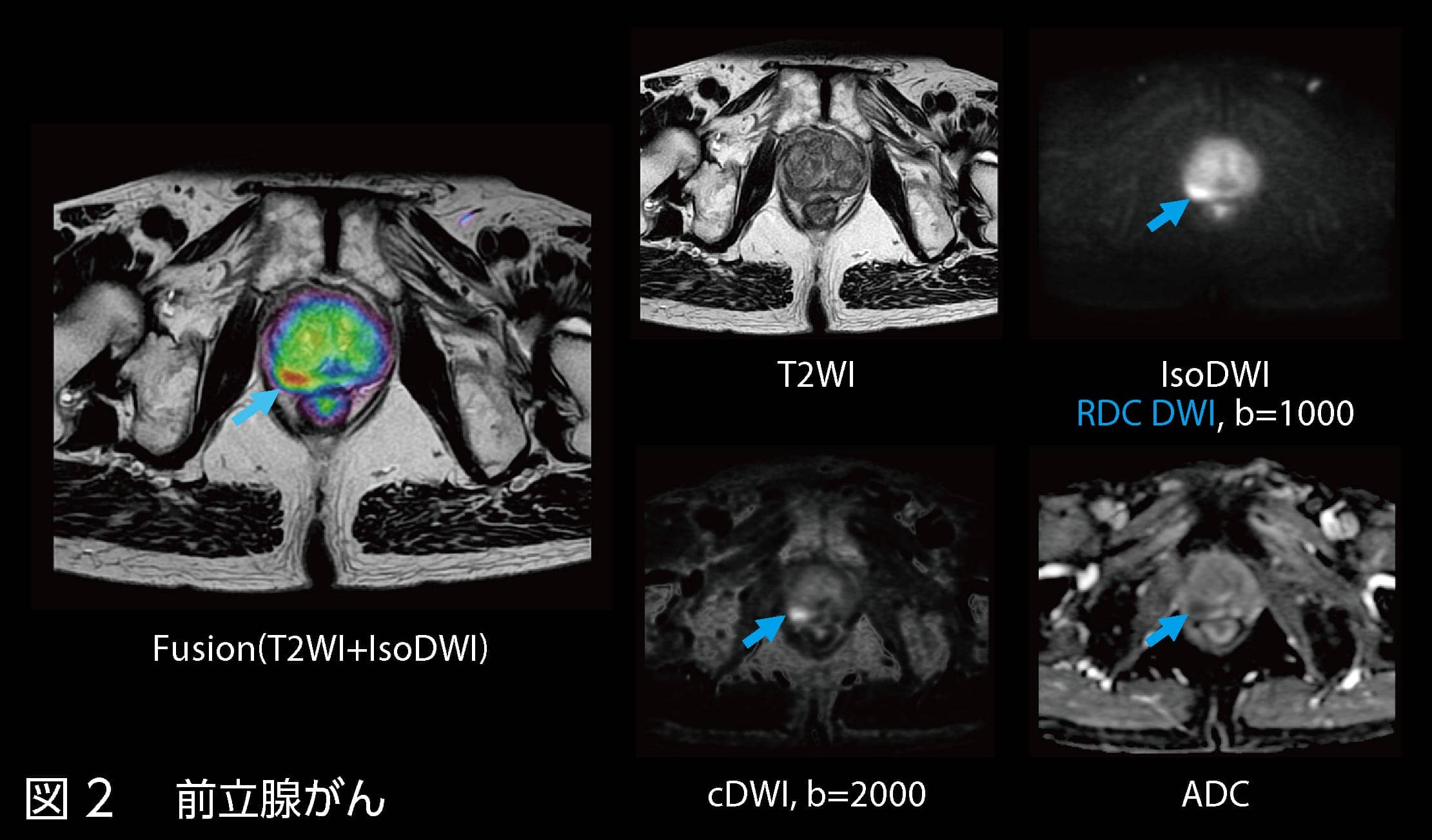 専用出品！mri〜様 □当クリニックの放射線科 - あぜみち脳神経クリニック