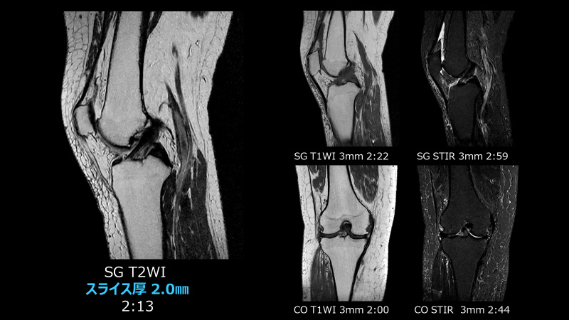 Fig.1 Thin Slice画像含むルーチン画像