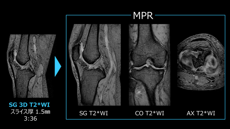 Fig. 2 3D撮像とMPR処理