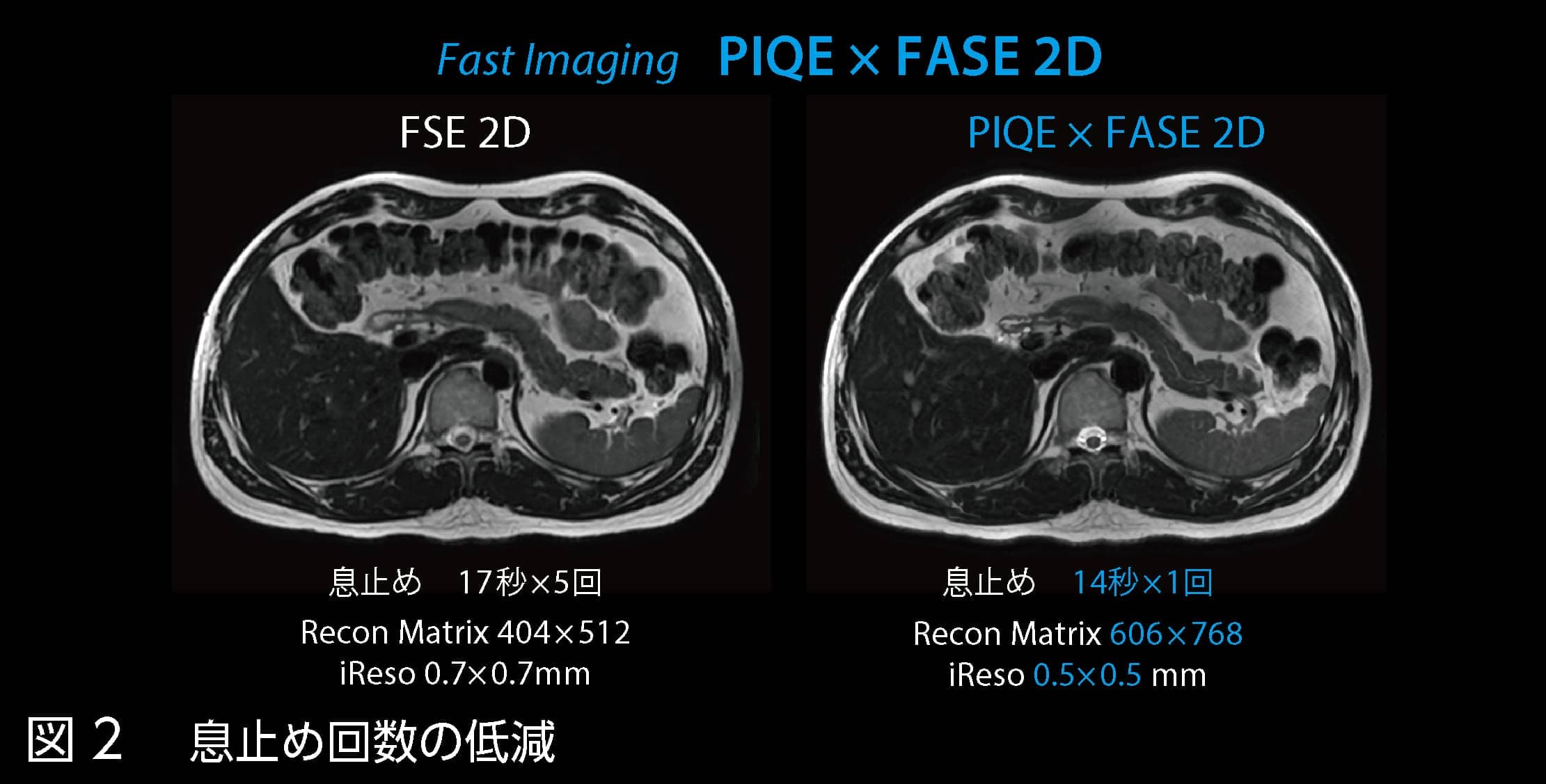Vantage Galan 3T / Supreme Editionの初期使用経験｜本城クリニック様