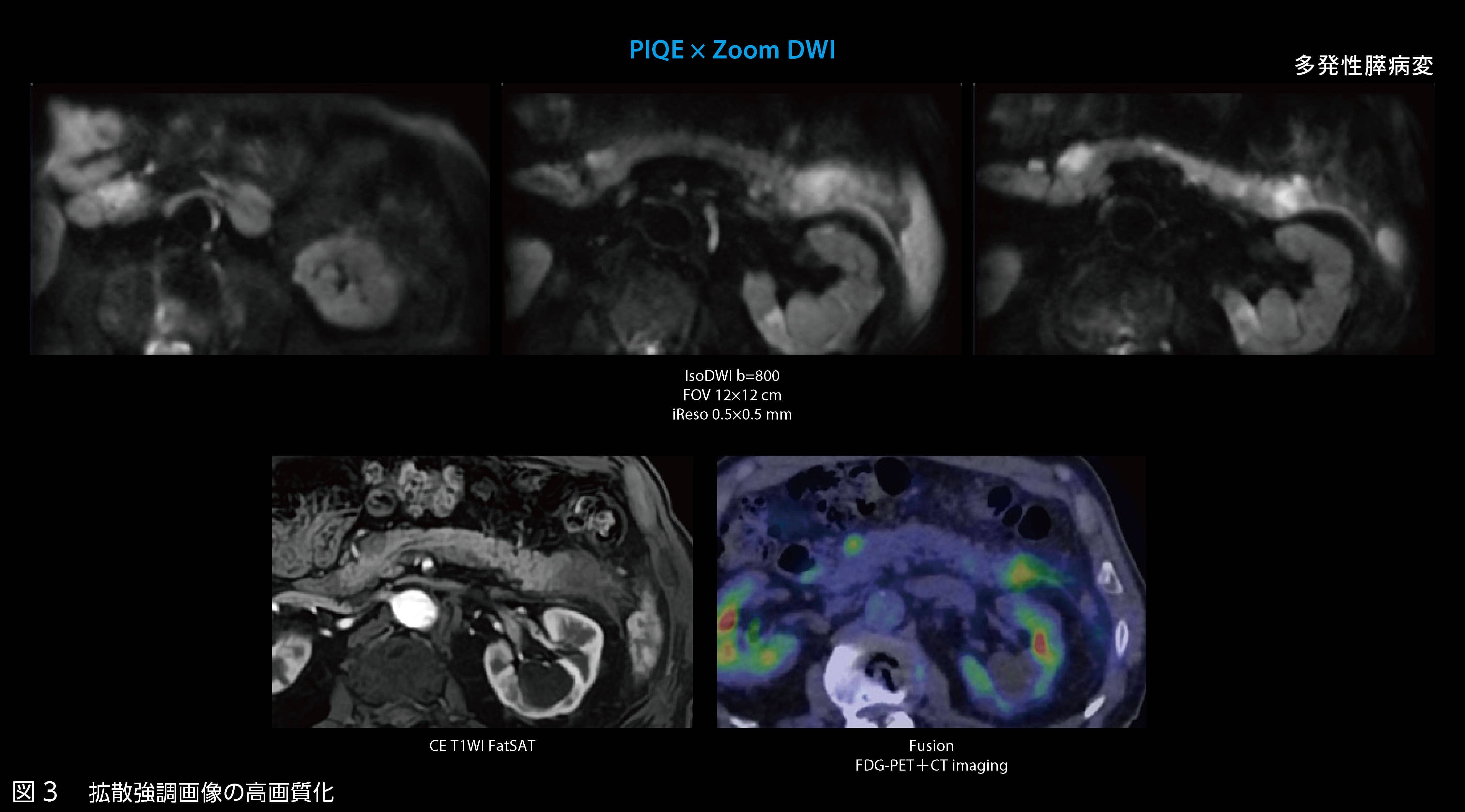 Vantage Galan 3T / Supreme Editionの初期使用経験｜本城クリニック様