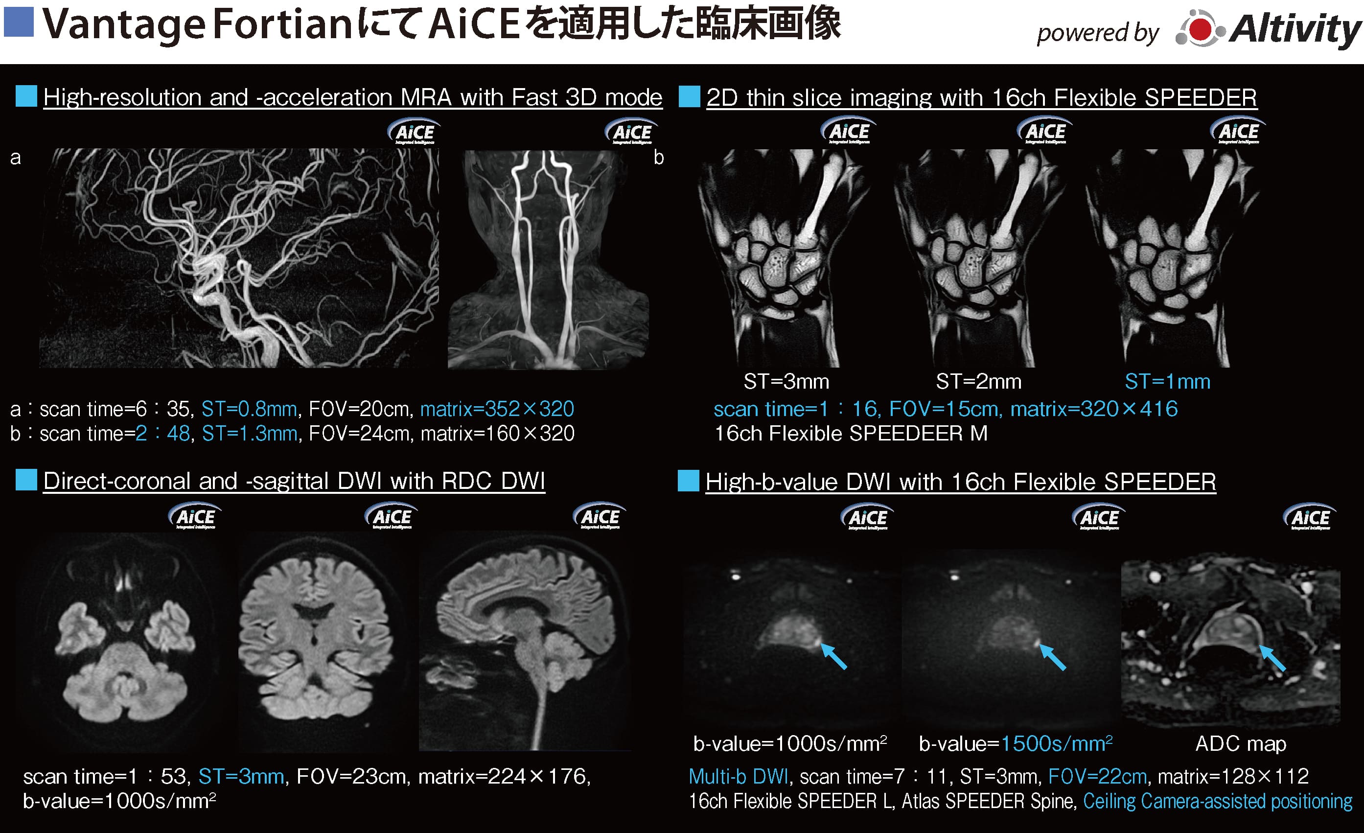 Vantage FortianにてAiCEを適用した臨床画像