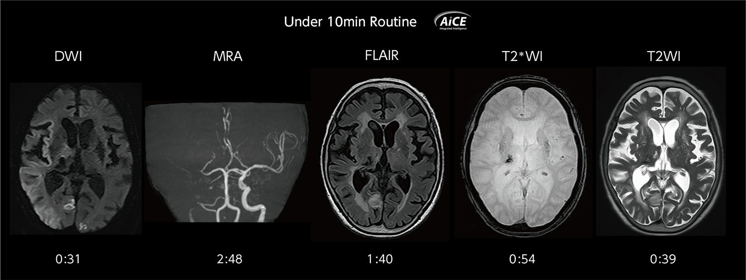【美品・電子版使用済】Diagnostic Imaging: Brain 脳画像 9-1_2021 Vantage Galan 3T / Focus EditionにおけるAiCEの使用経験 量