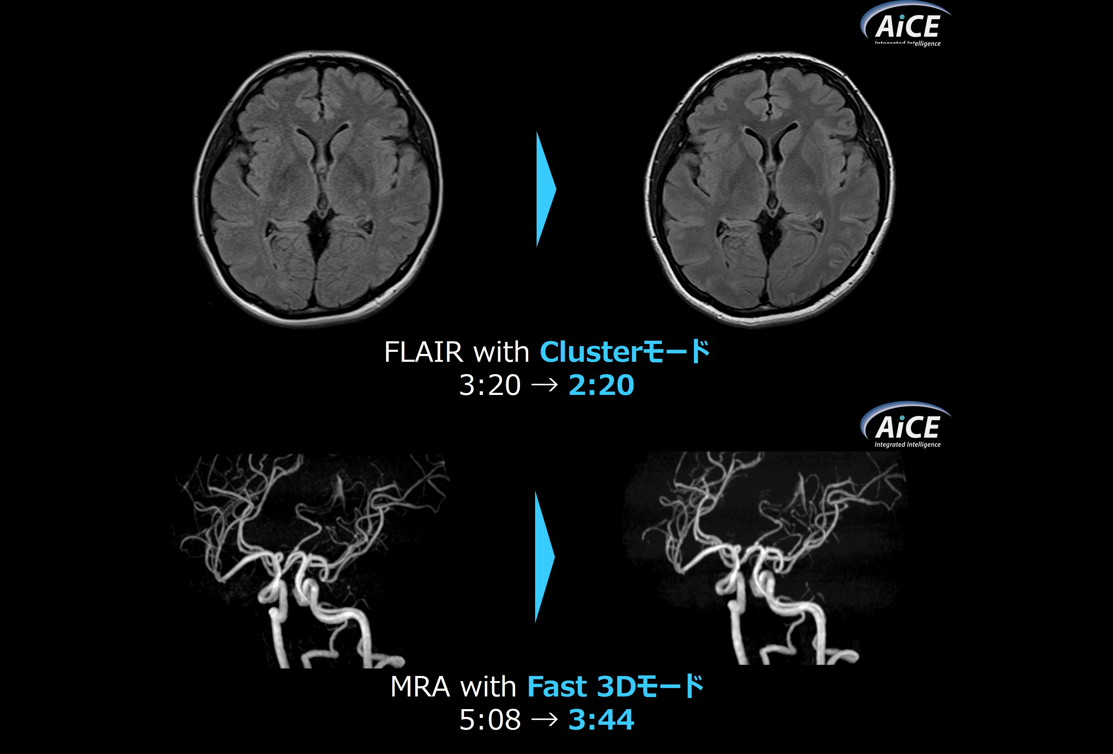 Fig.2. 画質向上と短時間機能