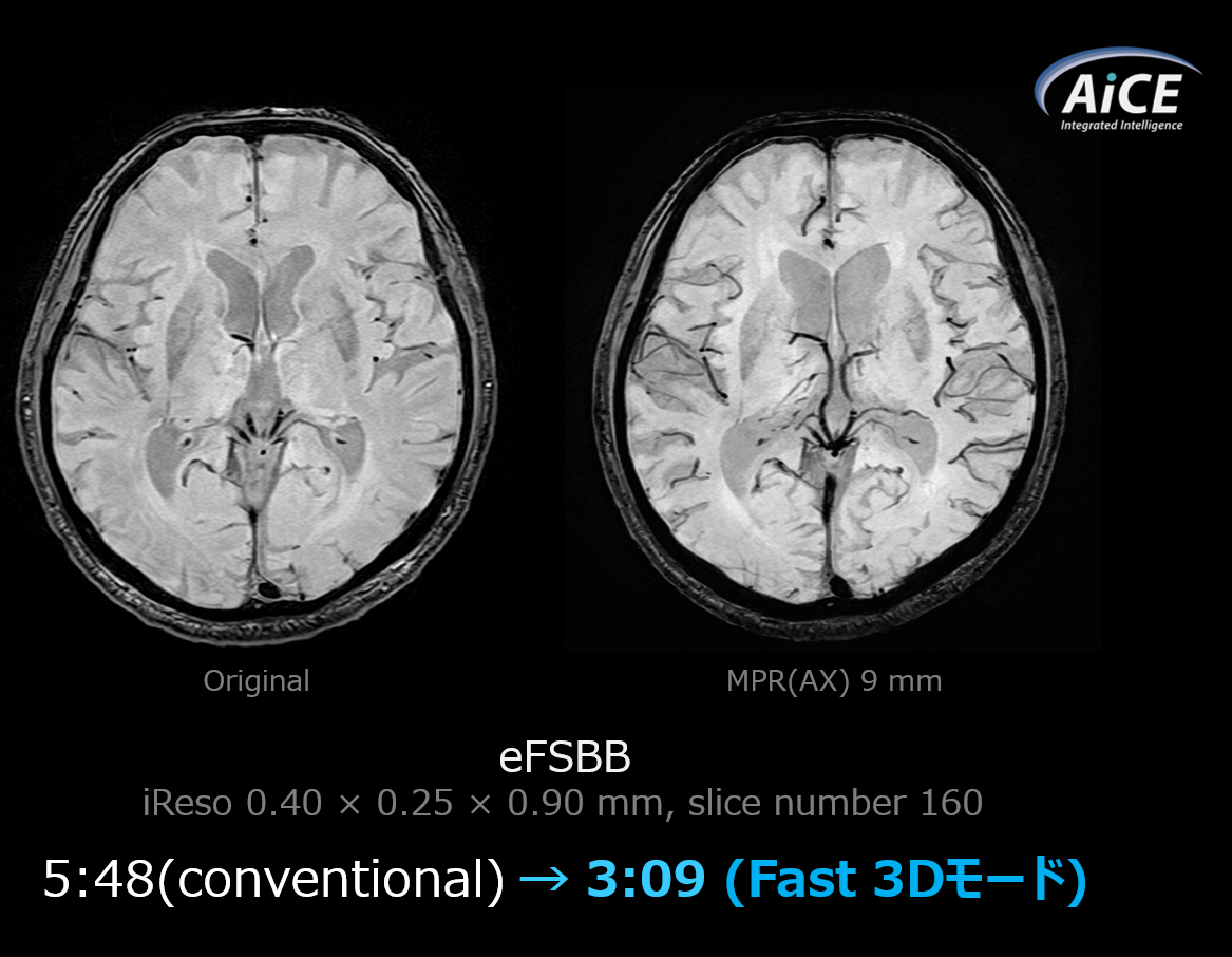 Fig.3. eFSBBにFast 3Dモードを使用した画像