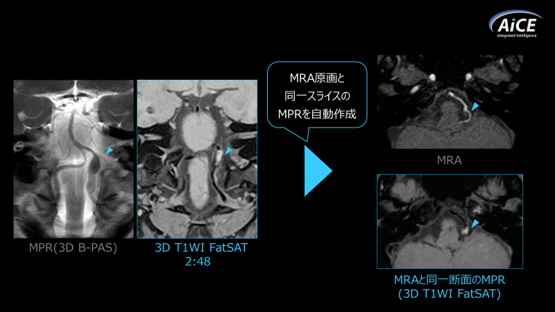 Fig.7. 同一断面に再構成可能なMPR処理
