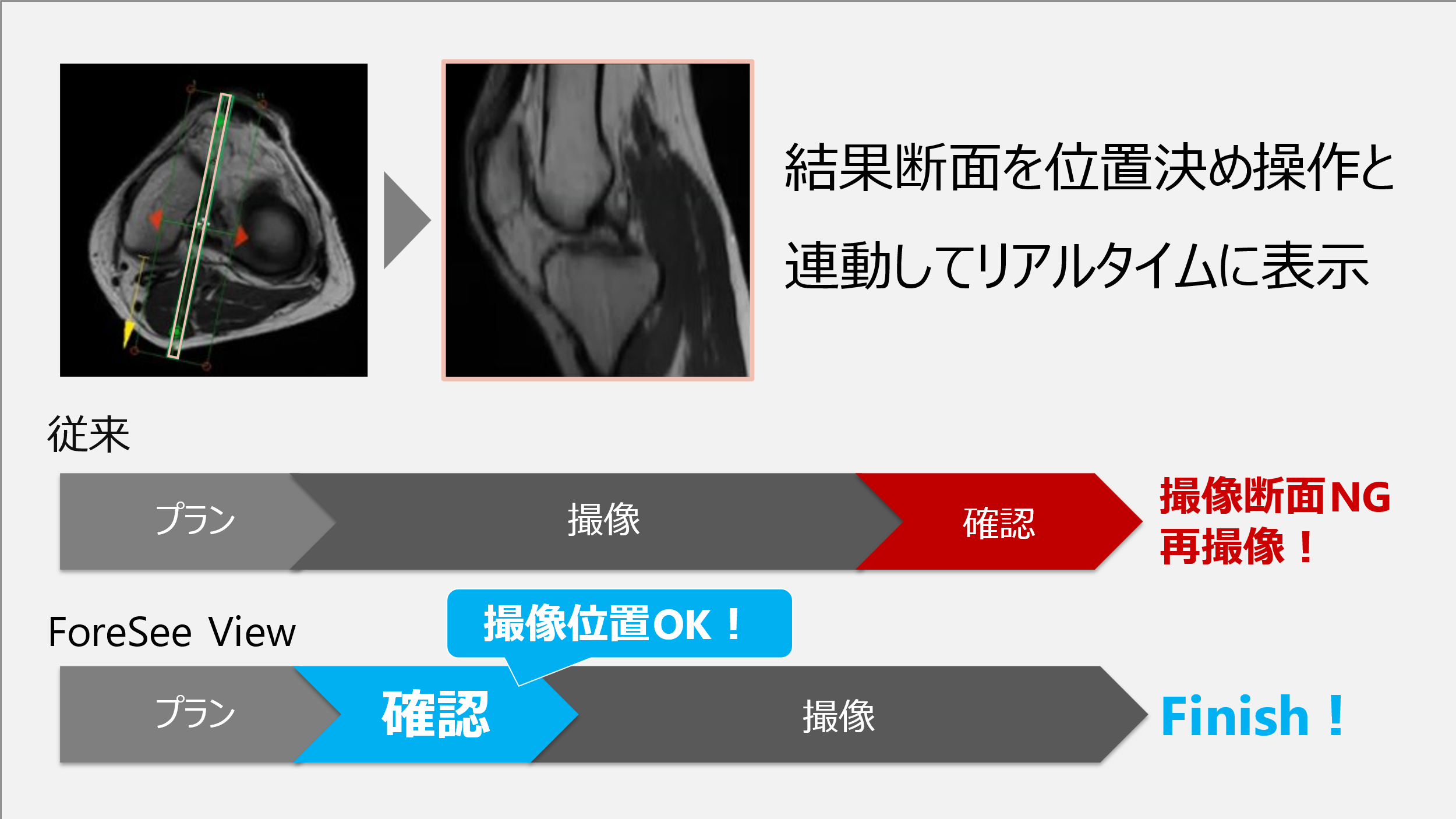 Fig.5 ForeSee Viewのイメージ図