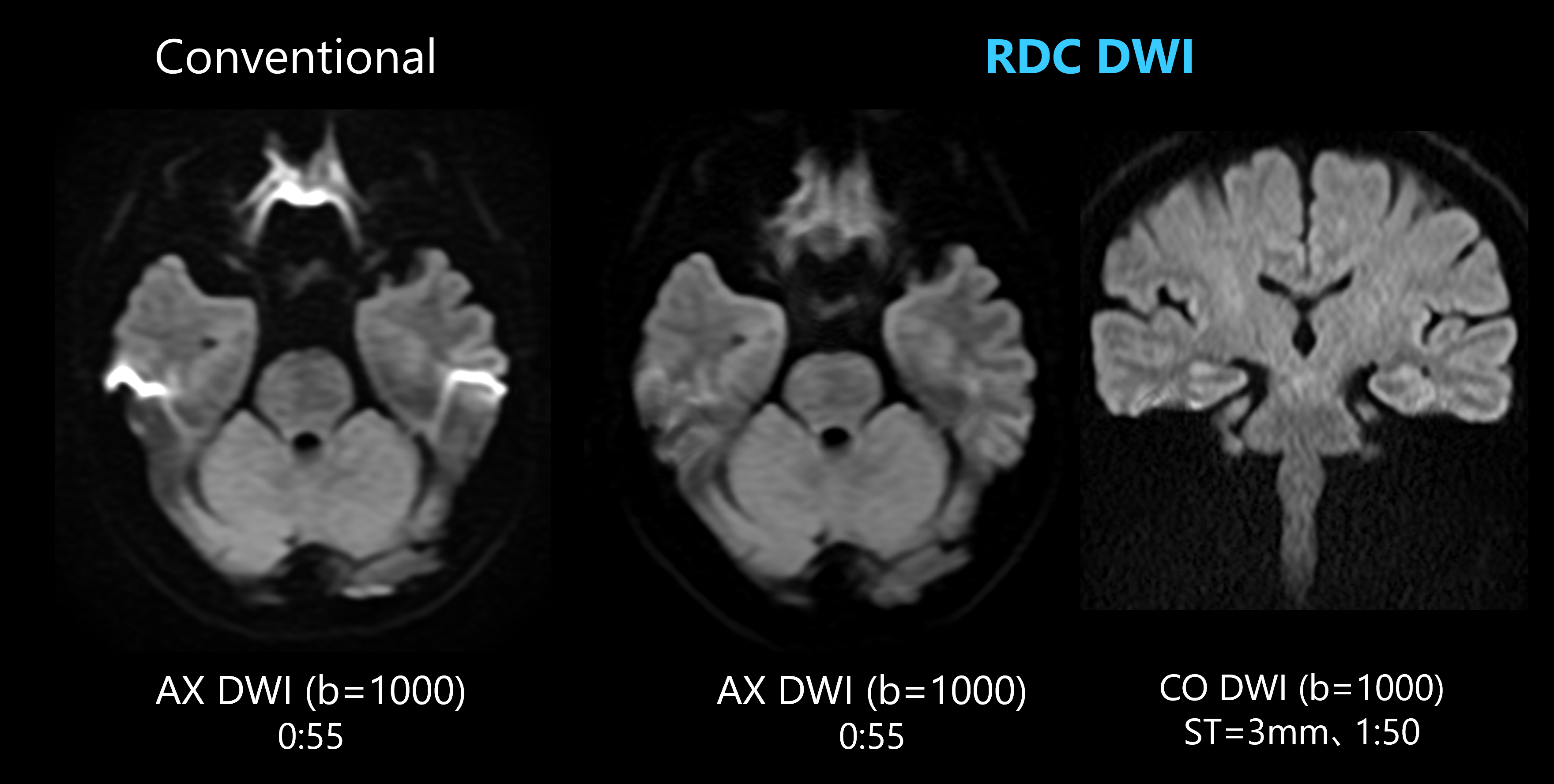 RDC DWI適用例