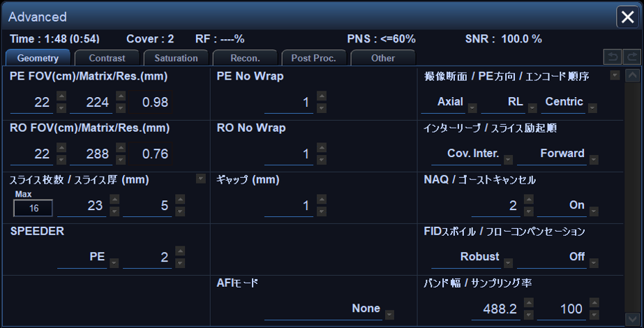 Vantage Gracian パラメーター設定画面