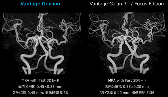 GracianとGalan 3Tの比較
