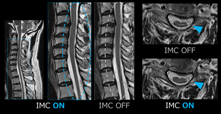 IMC前後の比較画像