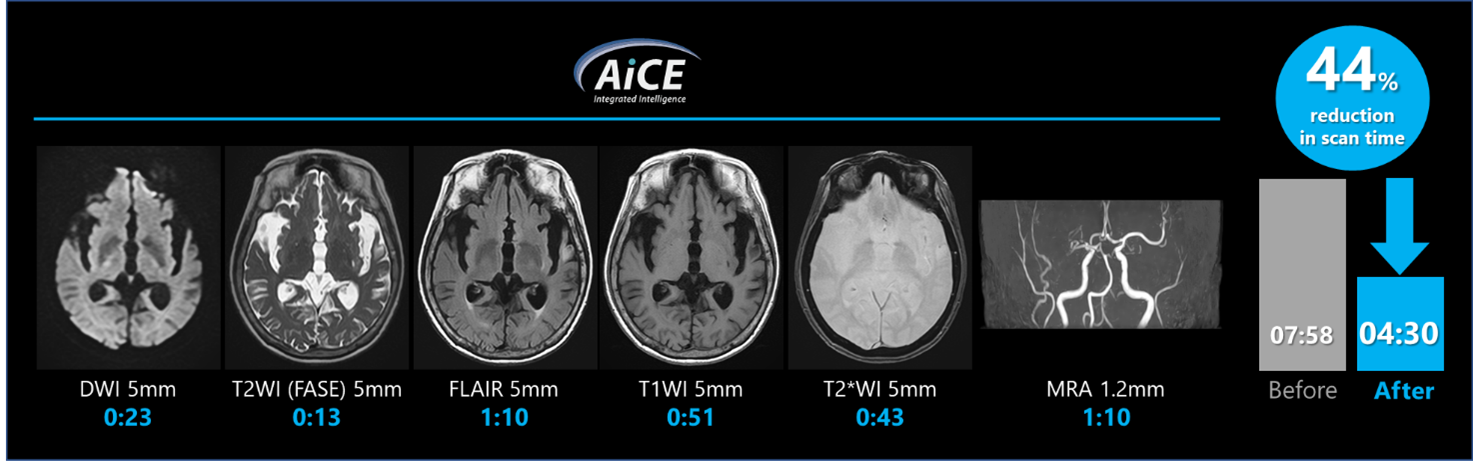 従来と比較した当院のGracianの短時間条件の図