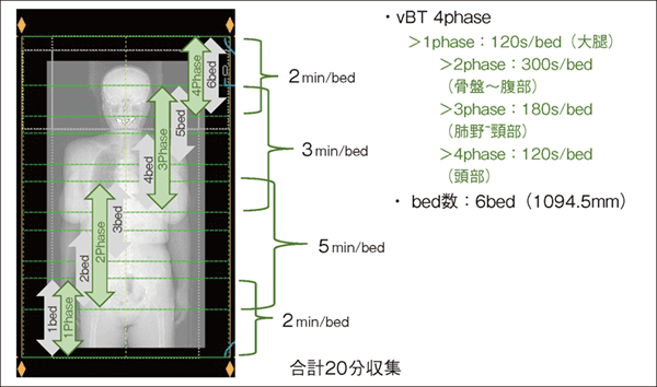 図5　vBTの使い方の一例