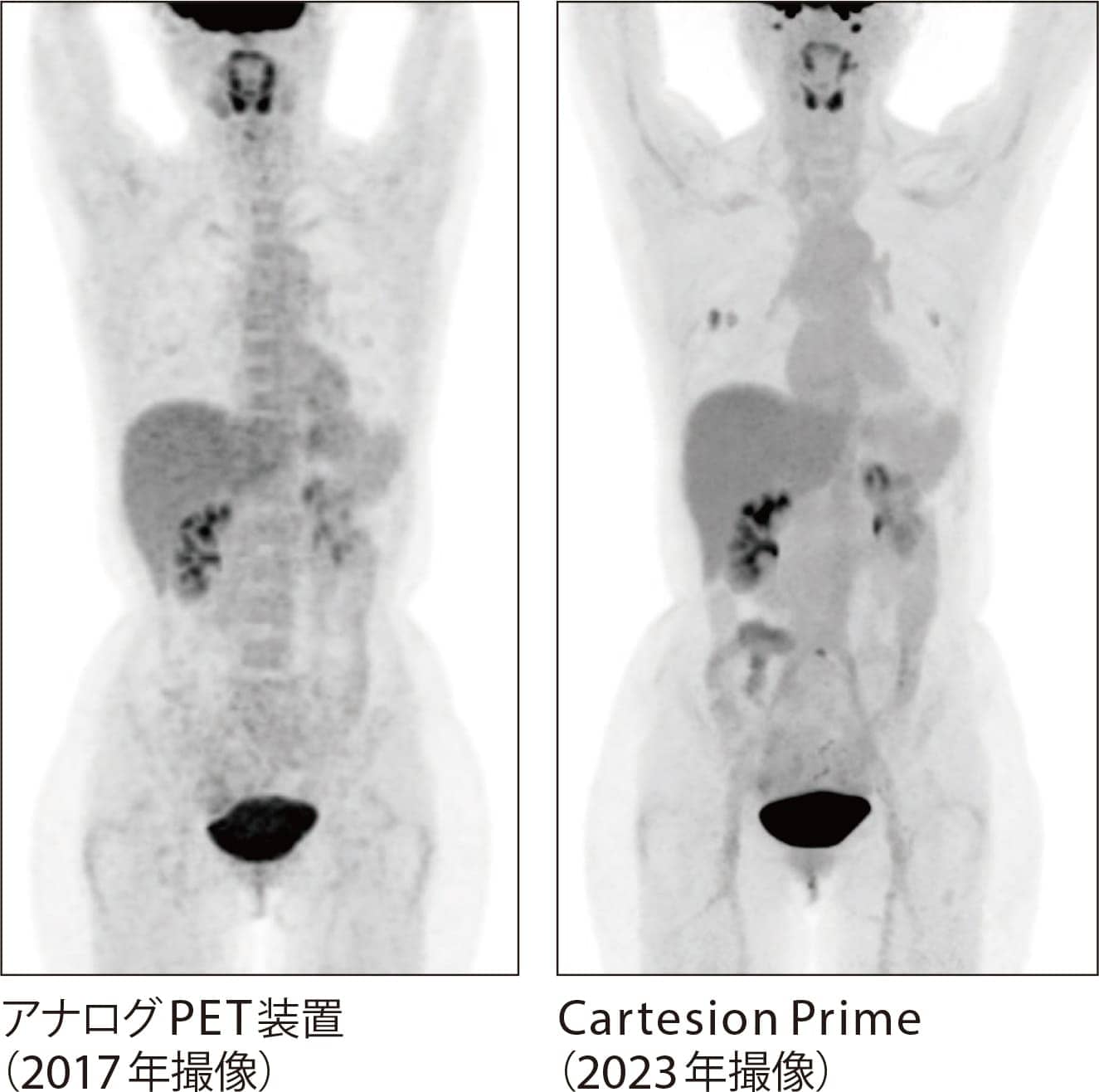アナログPETの比較画像
