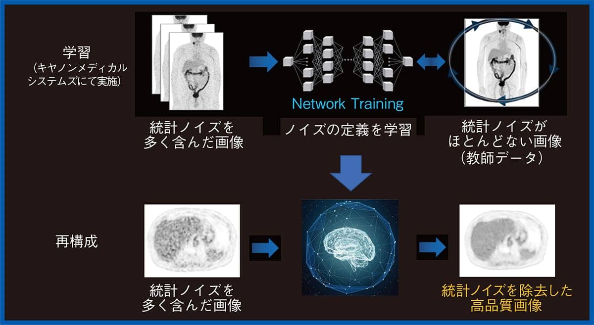 Advanced intelligent Clear-IQ Engine（AiCE）の概要図