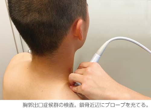 胸郭出口症候群の検査。鎖骨近辺にプローブを充てる。