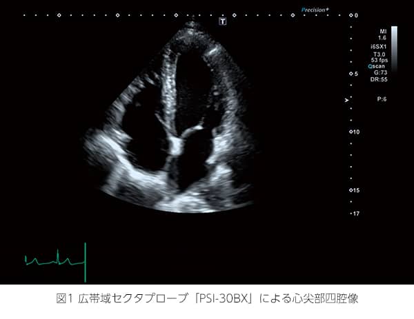 図1 広帯域セクタプローブ「PSI-30BX」による心尖部四腔像の写真