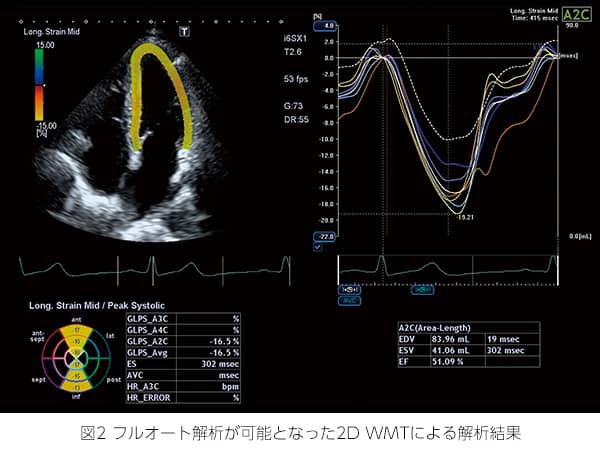 図2 フルオート解析が可能となった2D WMTによる解析結果の写真