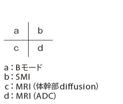 abcd図