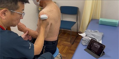 Aplio airを診療で活用している様子