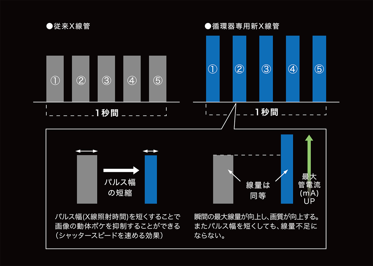 「新しい循環器専用X線管による画質は、これまでとは明らかに見え方が違う」