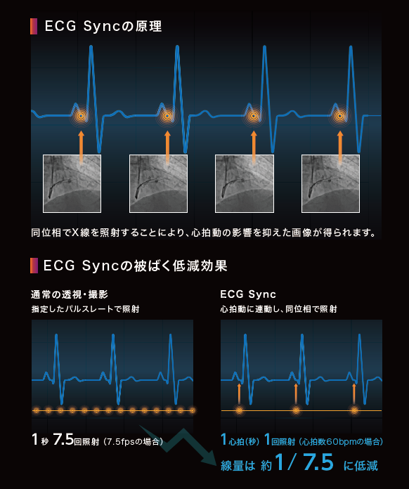 CTO-PCIの概念を変える“ECG Sync”